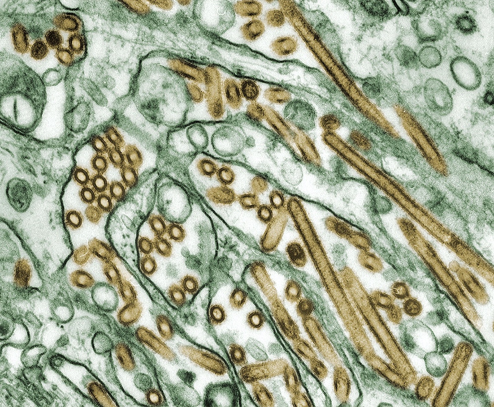This 1997 image depicts a digitally-colorized transmission electron microscopic (TEM) image of Avian Influenza A H5N1 viruses (seen in gold), grown in Madin-Darby Canine Kidney (MDCK) epithelial cells (seen in green). The Public Health Image Library from the Centers for Disease Control and Prevention (CDC) offers an organized, universal electronic gateway to useful and important public health imagery.